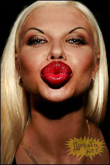 Botox Lips Porn Ro Master