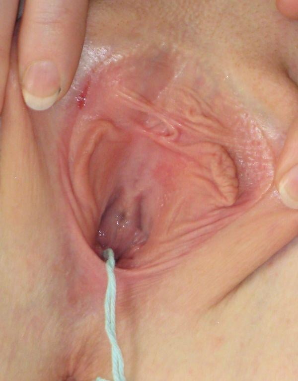 Vulva hanging out