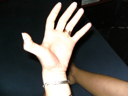 Ola 's Hand - flexible double jointed thumd