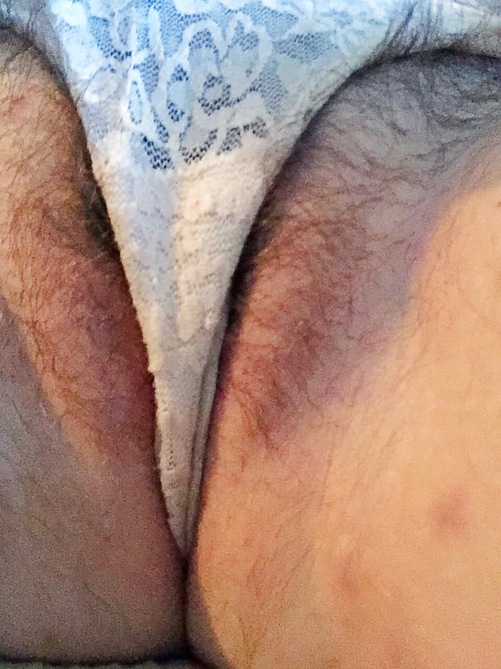 Hairy Pussies #17 porn gallery