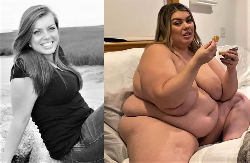 Weight Gain Before And After 7 - 31 Photos 