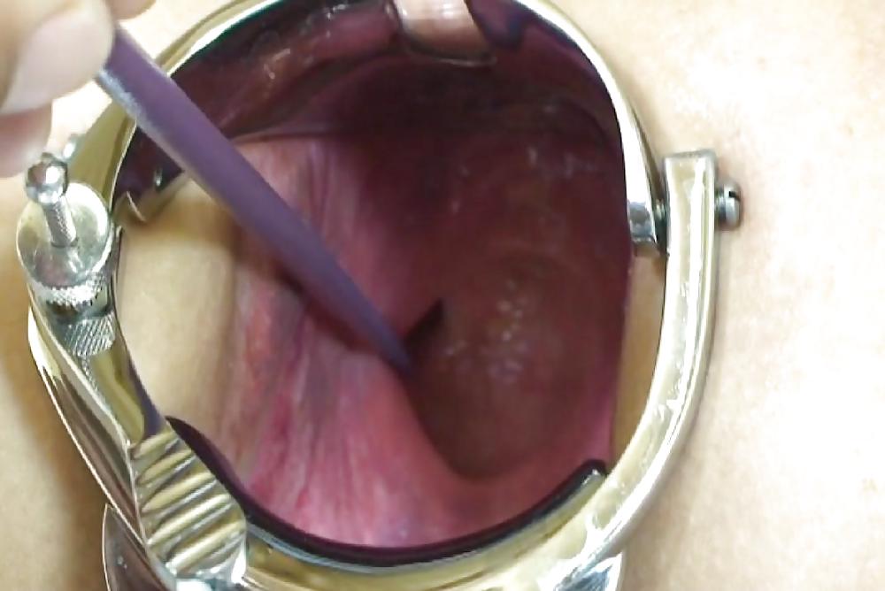 Pictures of incredible anal insertions by M.D.F. porn gallery