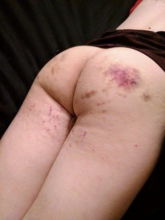 Bruised bleeding slut video