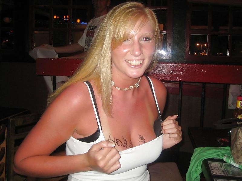 Sunburned Chicks porn gallery