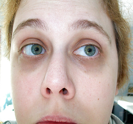 Me (Beware -- No Makeup)