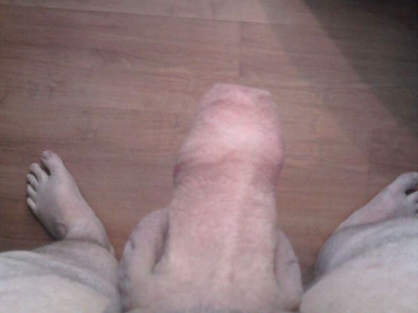 Mein Penis porn gallery