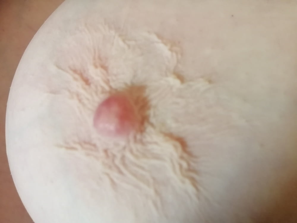 Erect mature nipples