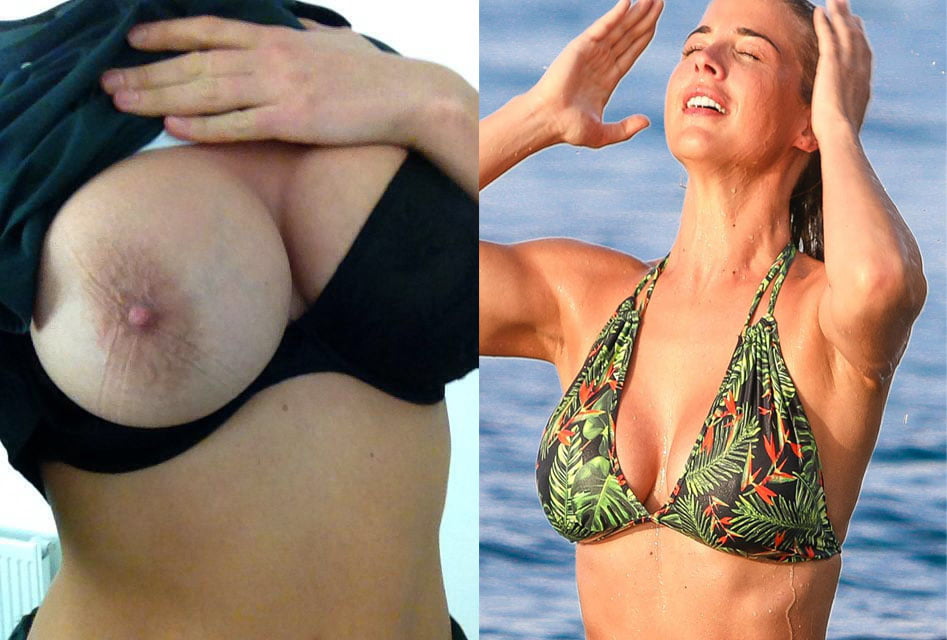 Atkinson leaked gemma The Breast