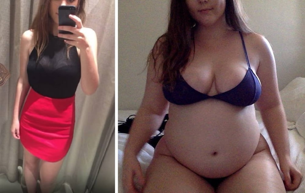 Weight Gain Before And After 7 - 31 Photos 