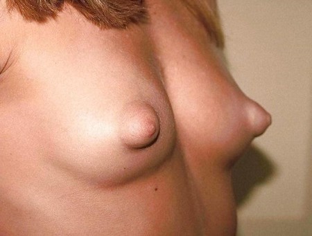 puffy nipples 08