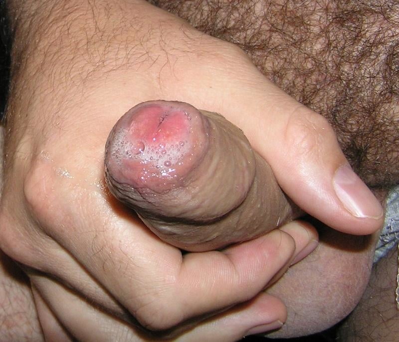 Tight Foreskin Covered Cocks 191 Pics 2 Xhamster