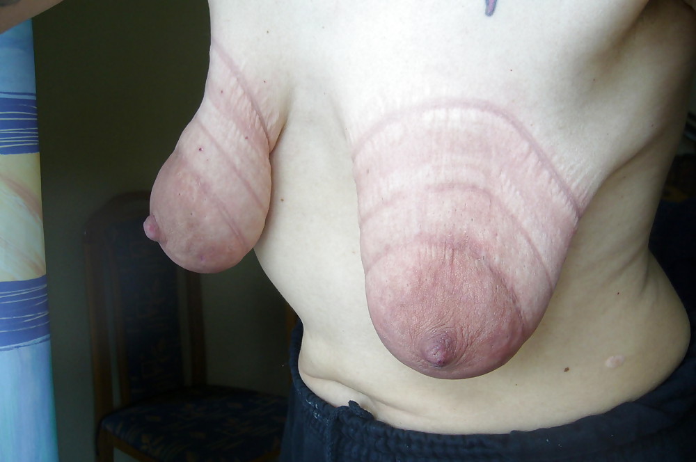 Tits extrem saggy Saggy tits