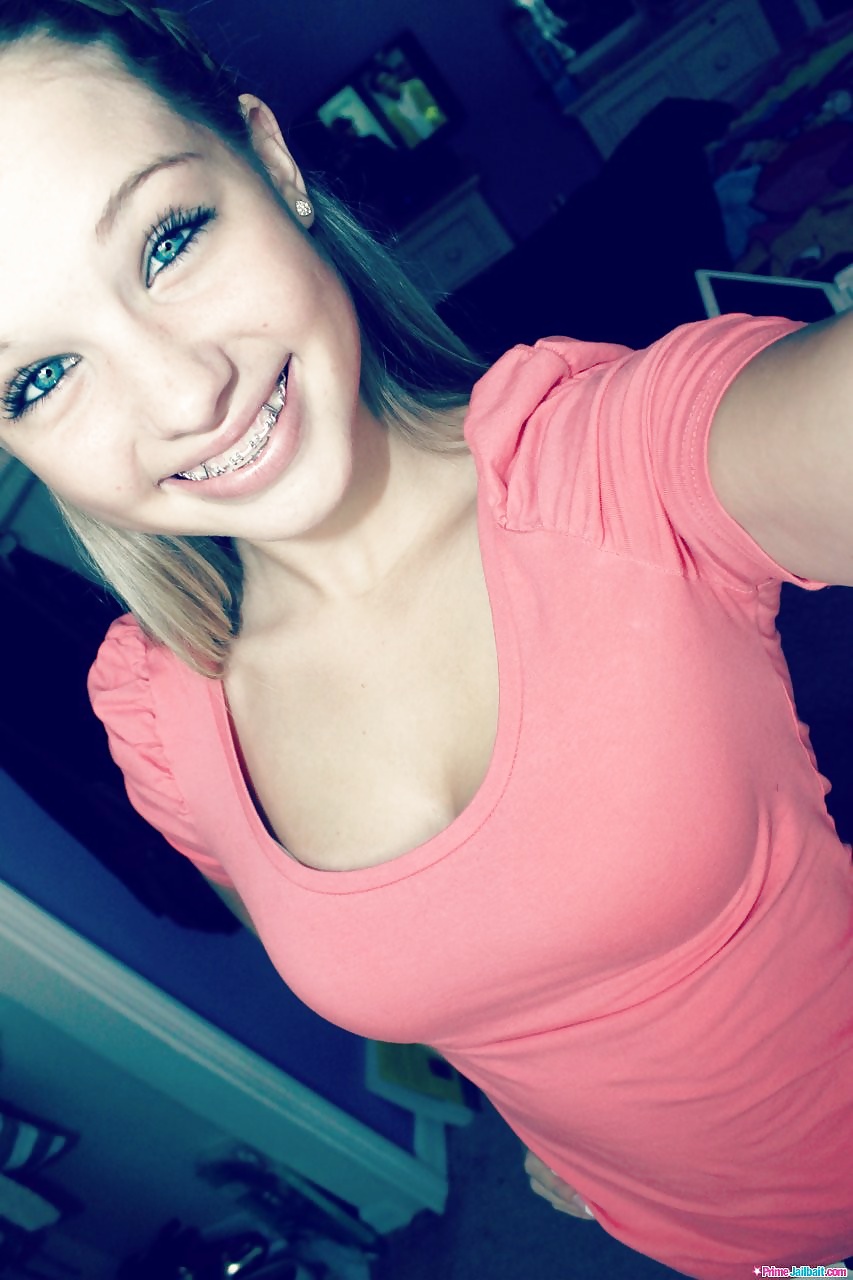 Sexy girl with braces young