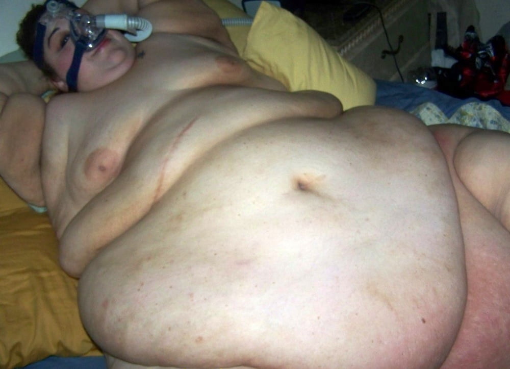 SSBBW With Breathing Or Mobility Apparatus - 15 Photos 