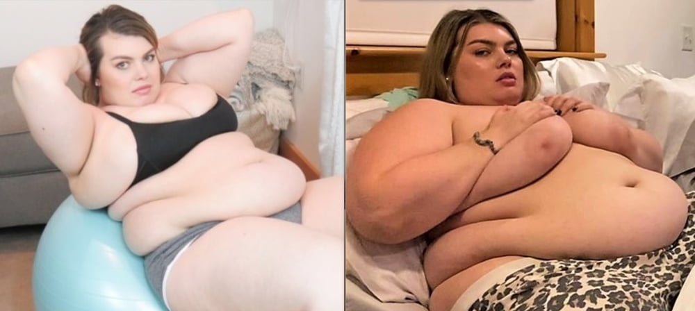 Weight Gain Before And After 7 - 31 Photos 