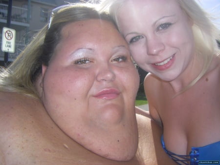 faces of obesity           