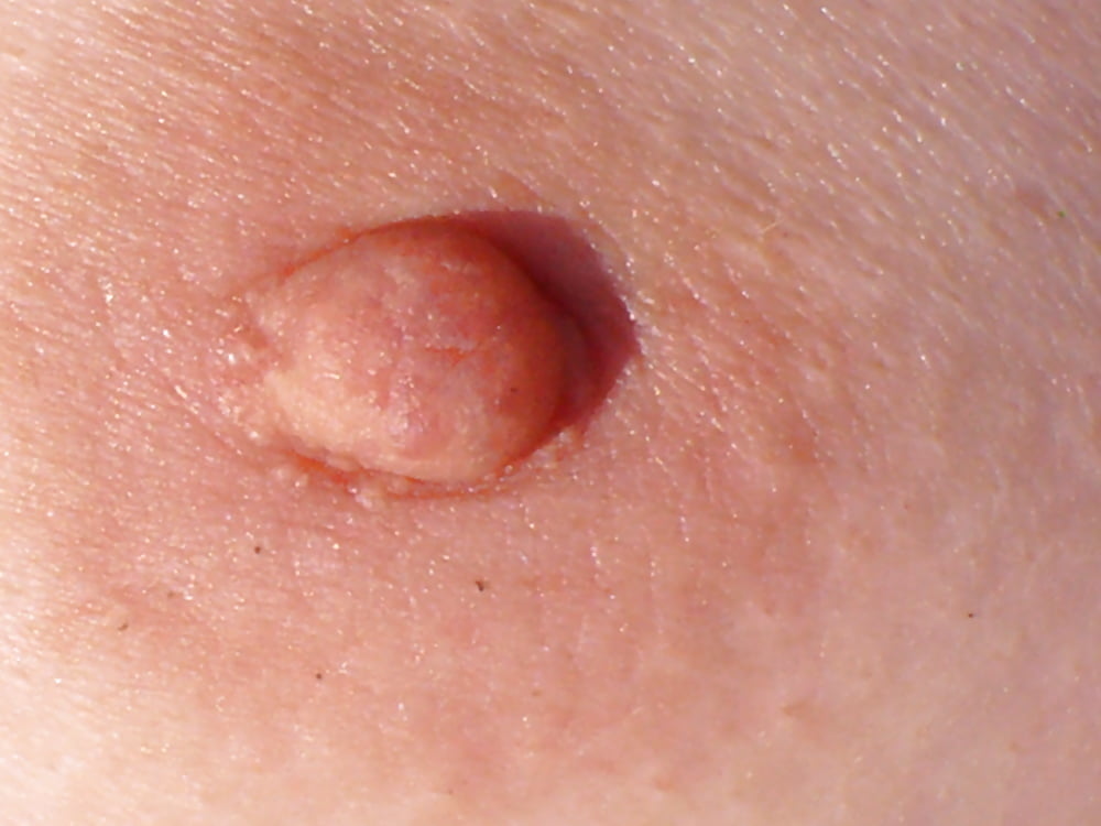 Nipples- 9 Photos 
