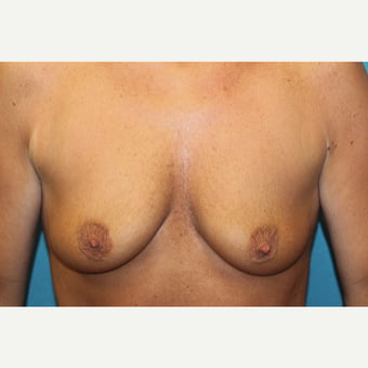 45-54 saggy breasts vol 2 - 94 Photos 